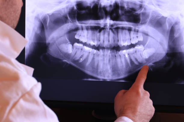 Best Emergency TMJ Treatment in Burien, WA