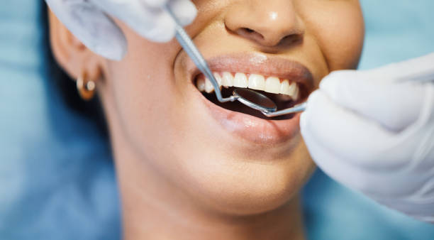 Best Emergency Gum Treatment in Burien, WA